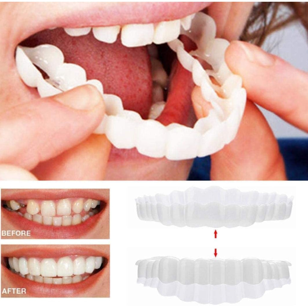 Dental Veneers Snap Teeth Veneers Smile Set - Image 9