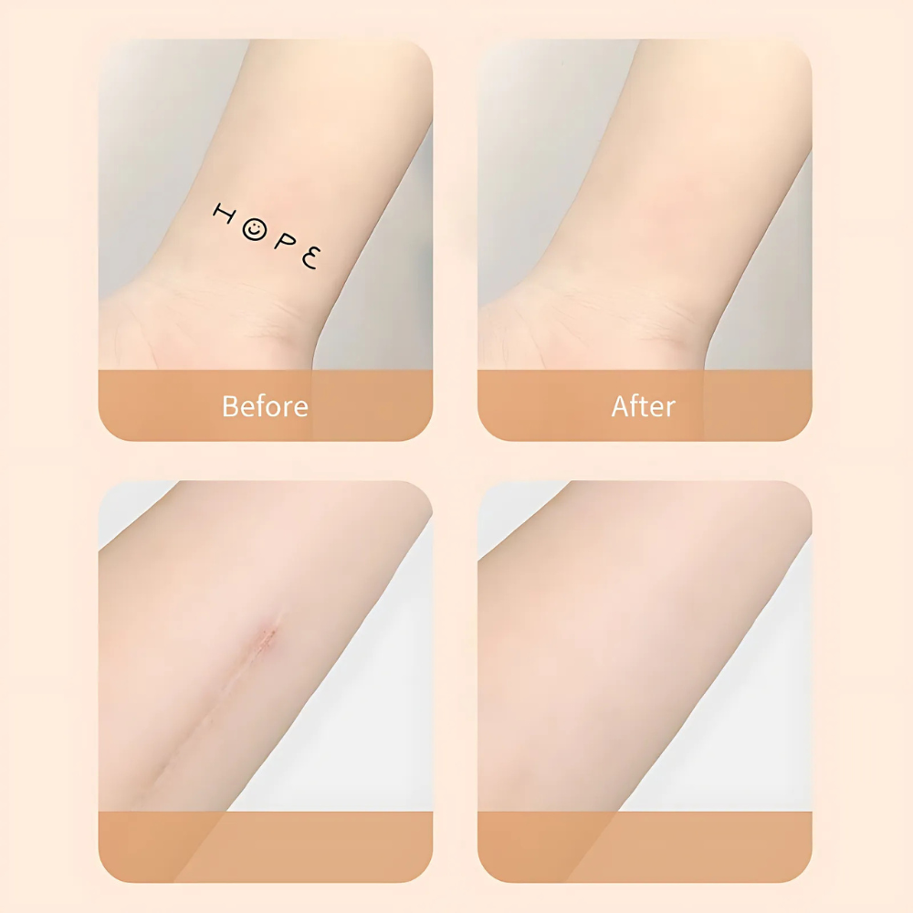 Scar Concealer Patch Skin Cover Invisible Healing - Image 5